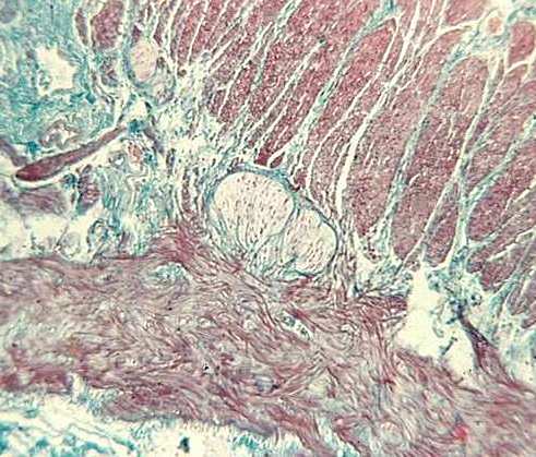 muscularis cirkulární TML-t.