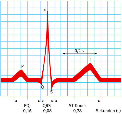 6. Ostatní příčiny akutní infekce (bronchpneumonie) vyvolají FIS, dále hypovolémie, hypotenze, hypoxémie, chirurgické výkony, katetrizace broncho a gastroskopie. 17.