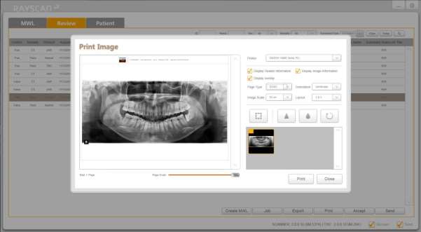 RAYSCAN l Ovládání software Print Priority Background Image Scale Tisková priorita Žádná, vysoká, střední, nízká Pozadí: černé, bílé Změna rozměrů vsadit, 10~200 % Rozložení Layout zvolte od