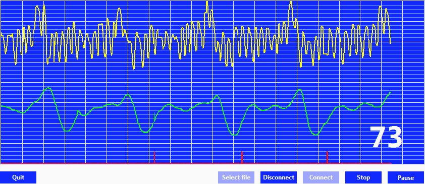 (a) 1 Hz aº 10 Hz (b) 1 Hz aº 3 Hz (c) 0,5 Hz aº 5 Hz (d) 0,5 Hz aº 4 Hz, ltr 3. ádu (e) 7 Hz aº 17 Hz, ád 3 17.