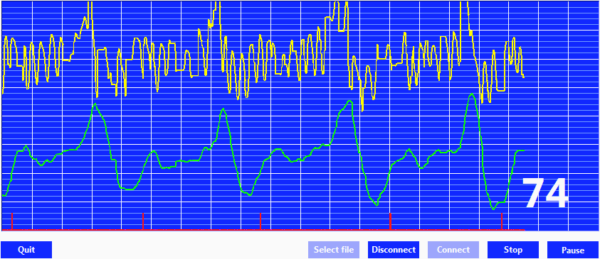 (a) Detekce ²pi ek a výpo et tepu ze signálu EKG (b) Detekce ²pi ek a výpo et tepu ze signálu PPG Obrázek 17: Detekce ²pi ek a výpo et tepu byla detekována ²pi ka signálu.