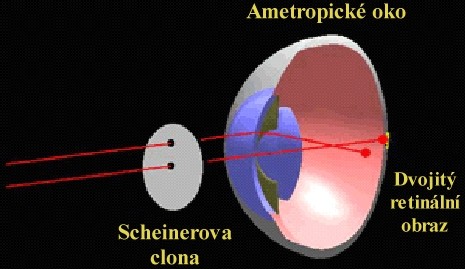 X - Scheinerův pokus a) ověření refrakční vady, b) blízkého bodu akomodace Pomůcky : bodový zdroj v nekonečnu, kartička papíru se dvěma minimálními otvory ve vzdálenosti cca 2 mm menší než průměr