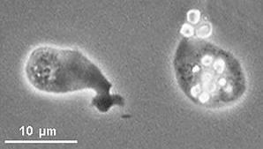 DERMATOPHAGOIDES Dermatophagoides. - Prachový roztoč. 707000 DIENTAMOEBA FRAGILIS Dientamoeba Fragilis(Protozoa Mastigophora), nevytvářejí cysty, trofozoiti mají 1 nebo 2 jádra.