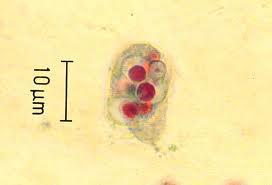 Eikenella corrodens 379500-384300 ENTAMOEBA GINGIVALIS