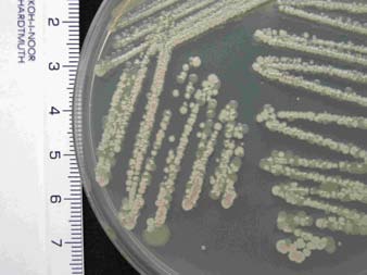 Abstrakt STANOVENÍ, CHARAKTERIZACE A IDENTIFIKACE BIOREMEDIAČNÍCH MIKROORGANISMŮ Jana Chumchalová, Eva Podholová, Jiří Mikeš, Vlastimil Píštěk EPS, s.r.o., V Pastouškách 205, 686 04 Kunovice, e-mail: eps@epssro.