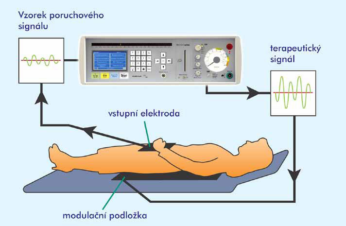 Obrázek 9 Základní zapojení přístroje při terapii Zdroj: (48, s.