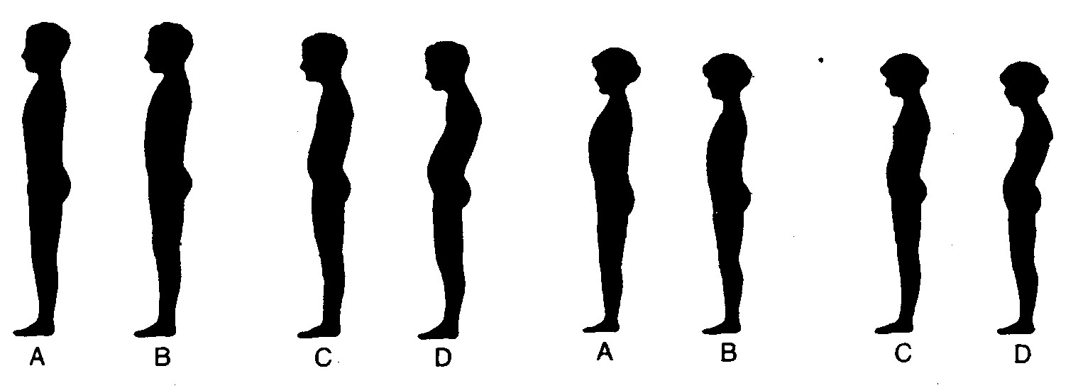 3 Správné a vadné držení těla 3.1 Charakteristika Držení těla je v každém věku výraz komplexní souhry tělesných a duševních faktorů, jejichž ovládání podléhá mnoha vlivům. Svou roli hraje např.