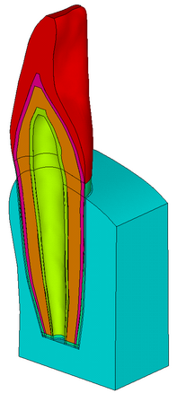 Obr. 8: Importovaný model řezáku s fragmentem čelisti 5. Výpočtový modelu zubu Po importu modelu do prostředí systému ANSYS je nutné provést jeho úpravu a kontrolu.