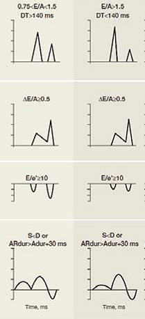 DIASTOLICKÁ DYSFUNKCE LK hypertrofie LK dilatace LS e < 9 cm/s E/e > 15