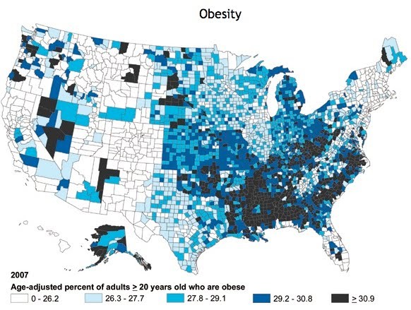 Výskyt obezity v USA Regionální