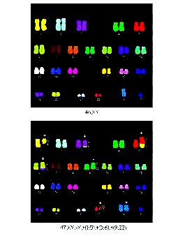 KARYOTYPY ČLOVĚKA - FISH (mnohobarevná hybridizace in situ mfish) Obr. č. 5: Karyotypy připravené metodou FISH.