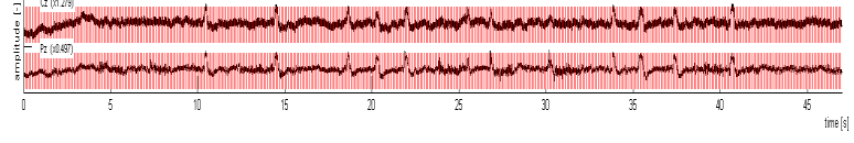 Segmentace signálu (konstantní délka segmentů) 0.1 s 0.