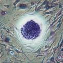 2 typy buněk v bazální vrstvě Pomalu dělící se epidermální buňky Rychle dělící se buňky Nahrazují mrtvé buňky odlučující se z vrchní vrstvy kůže.