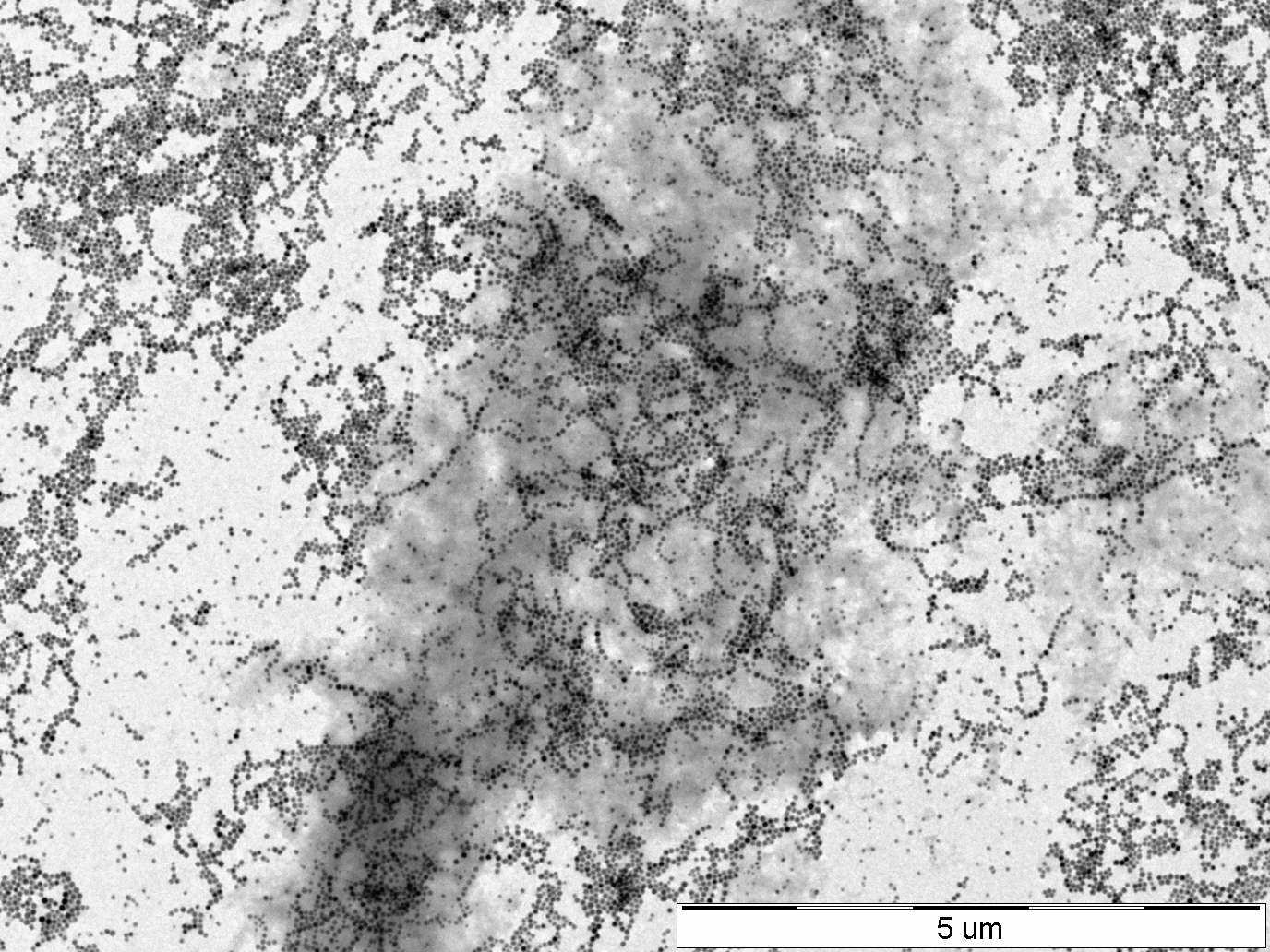 Úprava povrchu magnetosomů a funkcionalizace Hlavním cílem skupiny, zabývající se v Centru pro výzkum nanomateriálů magnetotaktickými bakteriemi, je získat čisté magnetosomy bez zbytků