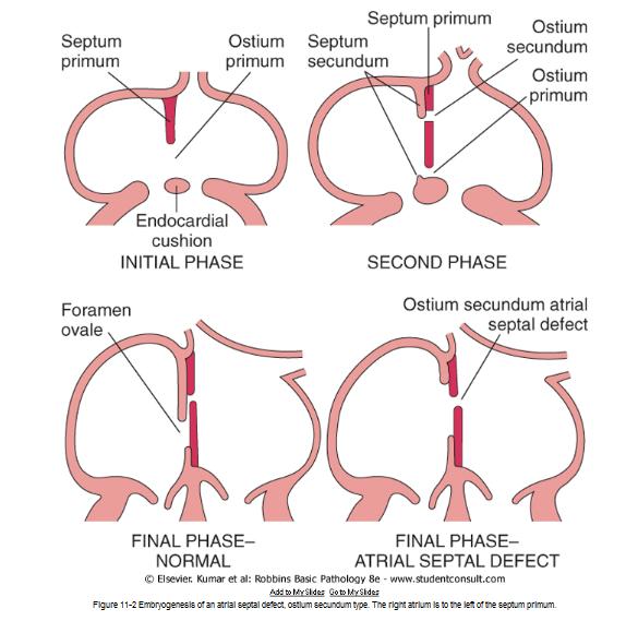 aorty možnost komprese jícnu a dýchacích cest Arteria lusoria odstup pravé a.