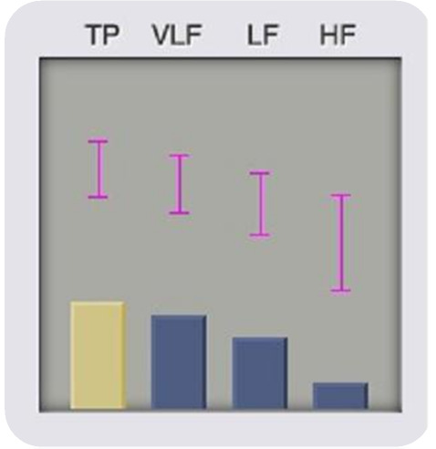 VLF (very low frequency) - Kolísání TF s velmi nízkou frekvencí.