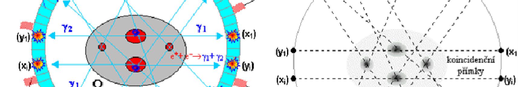 Obrázek. 20: PET/CT Zdroj: FN Lochotín Obrázek.