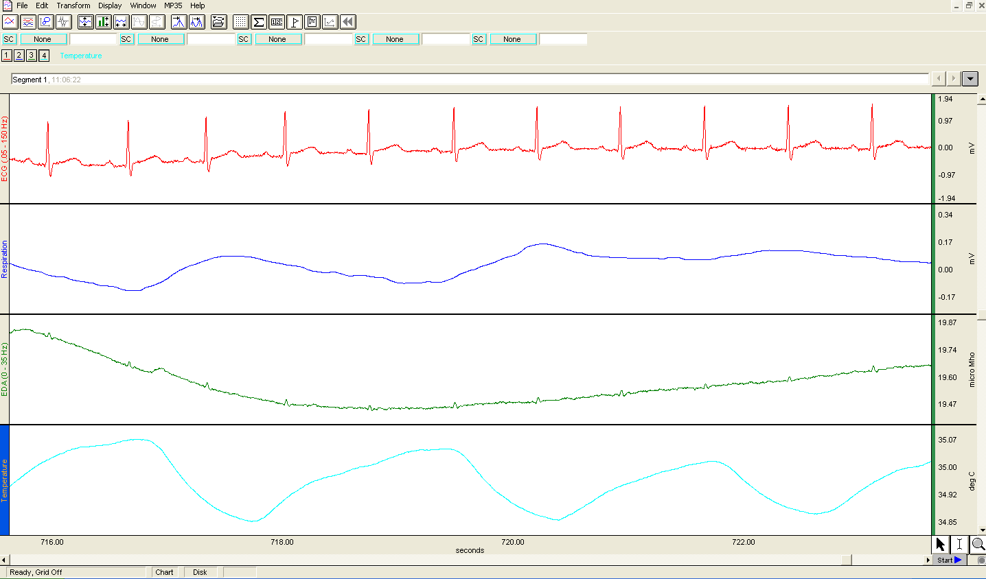 Tabulka 12: Technické parametry jednotky Biopac MP35 - převzato z (BSL Hardware Guide 2013, s.