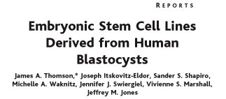 A B C D E F Jednotlivé kroky ustavení linie lidských EK buněk. A) Lidská blastocysta se zona pellucida.