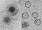 HCMV Ubikviterní beta-herpetický virus - 40-100% světové popoulace Primární infekce - mírné nebo asymptomatické onemocnění Závažné až život