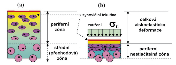 Obr. 3 Periferní zóna ACH v nezatíženém stavu (a) a při zatížení (b). Nestlačitelná oblast periferní části ACH je integrována s nestlačitelnou střední a dolní vrstvou ACH (při velkých zatíženích).