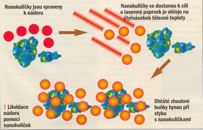 Vývoj těchto zlatých nanostřel pokračuje dál. Ty jsou nyní schopné se sami navádět na cíl.