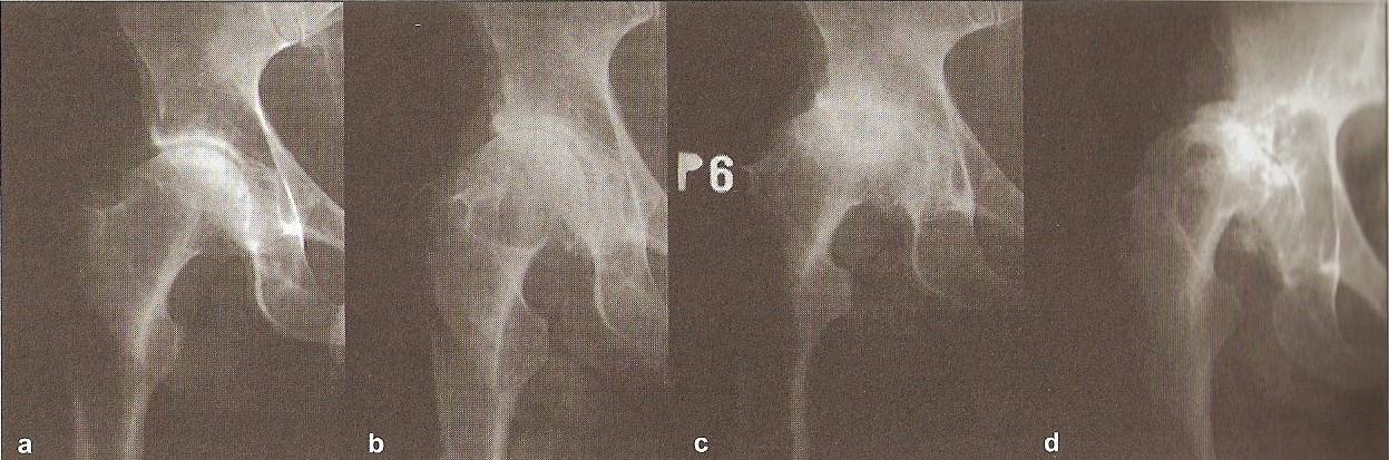 depuyorthopaedics.com) PŘÍLOHA II. PŘÍLOHA K TEORETICKÉ ČÁSTI Obr.