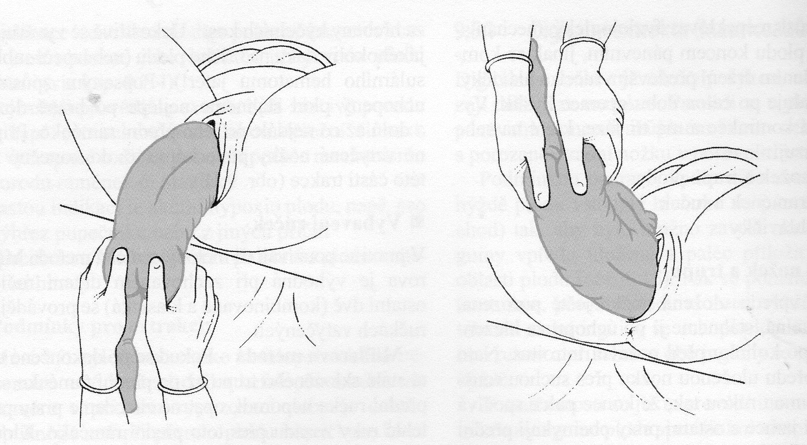 479) Obrázek 11: Müllerova metoda vybavení