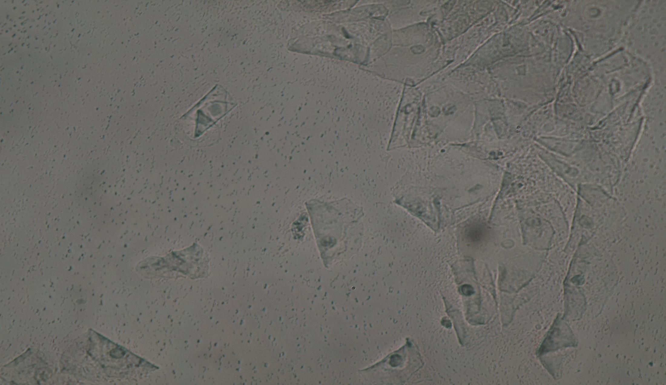 Lactobacillus spp. L. acetotolerans L. acidifarinae L. acidipiscis L. acidophilus L. agilis L. algidus L. alimentarius L. amylolyticus L. amylophilus L. amylotrophicus L. amylovorus L. animalis L.