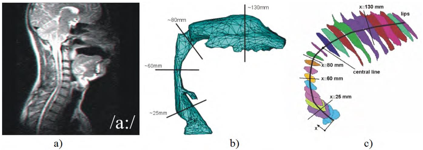 12.3 Modely geometrie Geometrie 2D modelu hlasivek je založena na velmi často používaném parametrickém M5 Shererově modelu [52], [76], viz Obr. 12.2. Hlasivková tkáň je modelována jako čtyřvrstvá obsahující epitel, laminu propriu, ligament a sval.