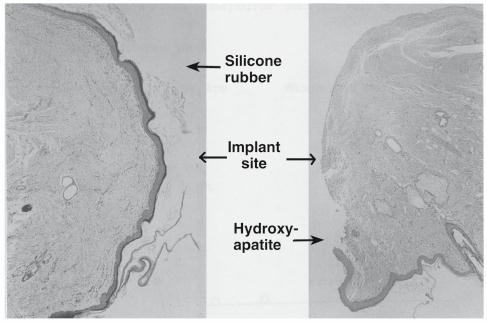 strukturální faktory vztahující se k biodegradaci řízené polymerem.