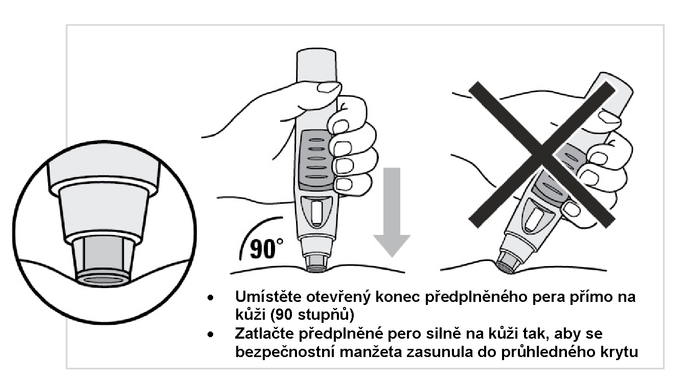 Předplněné pero silně přitlačte ke kůži (viz obrázky 5 a 6) Držte předplněné pero pohodlně v ruce. V tento okamžik tlačítko NEMAČKEJTE. Budete si moci vybrat ze dvou způsobů podání injekce.