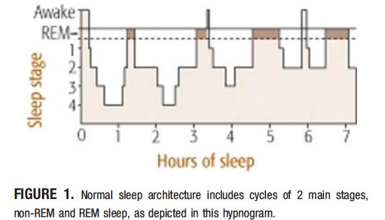Spánková architektura NREM spánek (75-80% TST) REM