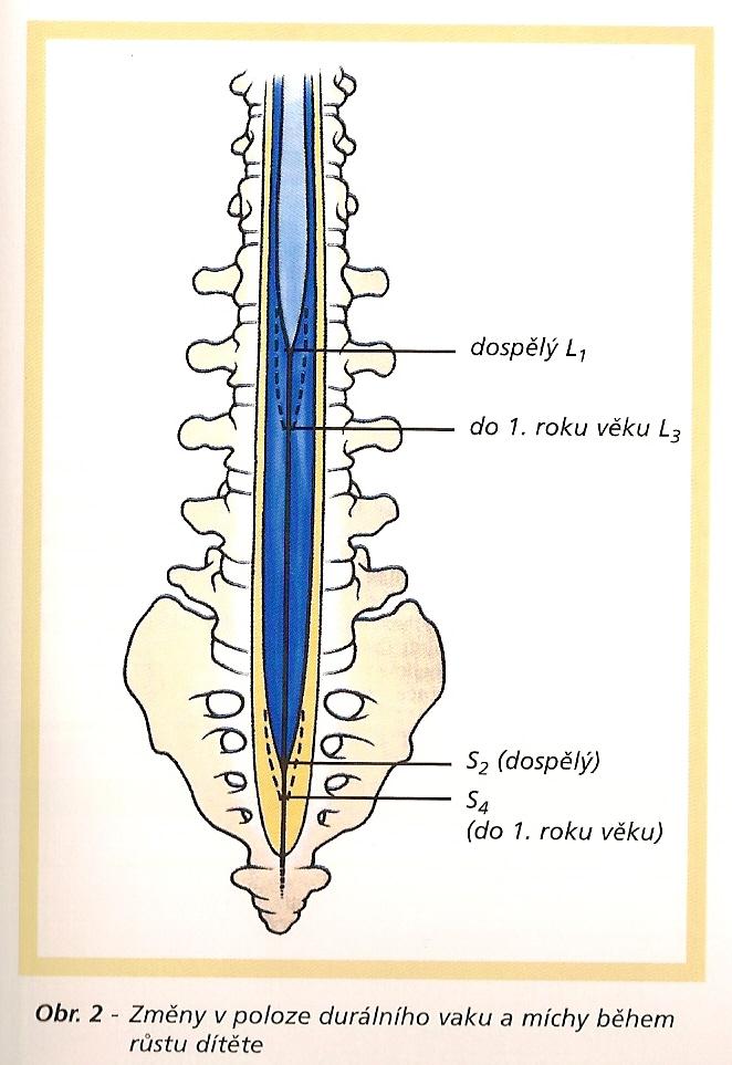 Anatomické rozdíly dětského věku nedochází k poklesu TK při epidurální a subarachnoidální blokádě ligamenta a fascie jsou tenčí a jemnější nedostatečná myelinizace nervových vláken do 18.