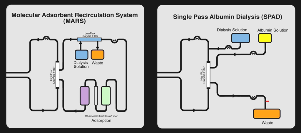 SPAD (single pass albumin dialysis) podobný systém jako MARS X krev pacienta je dialyzována proti mnohem více ředěnému roztoku albuminu na albumin bohatý dialyzát není recyklován obdobně jako u MARS