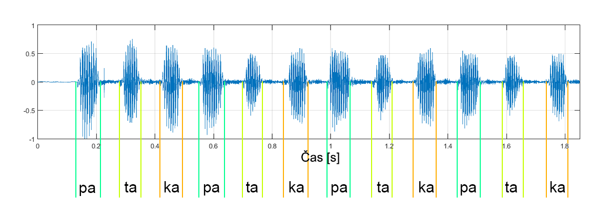 Obrázek 1.3 DDK úloha: /pa/-/ta/-/ka/ 1.