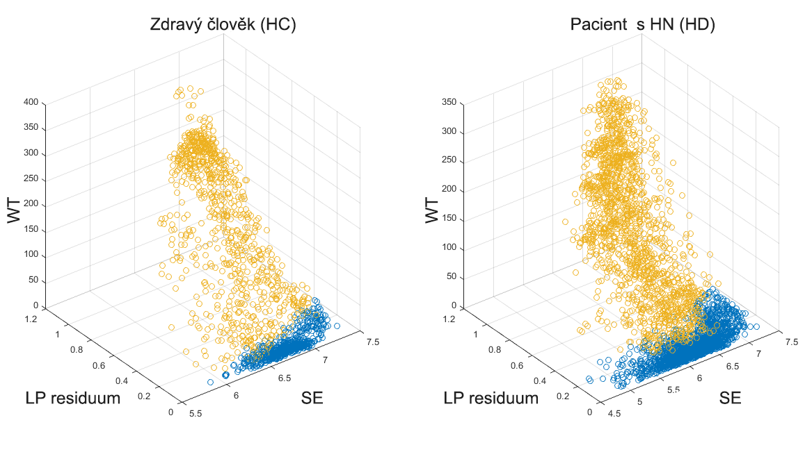 vždy definovat, který index patří vokálu a který patří neznělé pauze. K tomu slouží porovnání výkonů jednotlivých částí signálu s indexem 0 a částí s indexem 1.