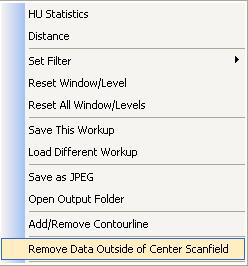 Rekonstrukce anatomie Tento předmět je možné odstranit z datového souboru tak, že pravým tlačítkem klikneme na Preview Screen a zvolíme Remove Data Outside of Center Scanfield.
