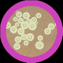 Penicillium Saccharomyces Tinea Stachybotrys Max velikost (nm) vlákno... 332 000 Max velikost (nm) buňka... 10 000 Max velikost (nm) vlákno... 110 000 Max velikost (nm) vlákno... 72 000 Počet druhů.
