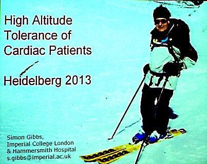 High altitude tolerance of cardiac patients Simon Gibbs.