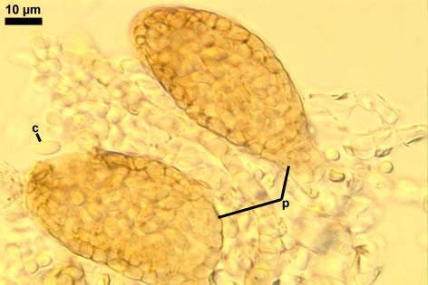 Ampelomyces quisqualis Ces. ex Schlecht.