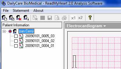 Přenesení průběhů z EKG přístroje do počítače Abyste s jednotlivými průběhy mohli dále pracovat, musíte nejprve příslušný průběh zatrhnout pomocí