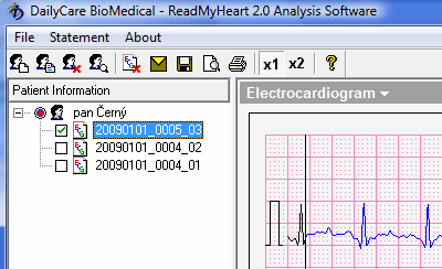 Přenos průběhů z EKG přístroje (3 naměřené průběhy). Obrázek 12.