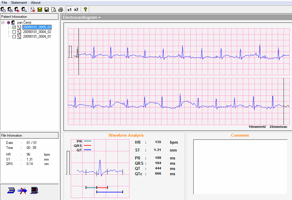 Správa uživatele V levé horní části okna programu se nachází funkční menu pro efektivní práci s naměřenými průběhy z EKG přístroje. Obrázek 17: Funkční menu programu Obrázek 16.