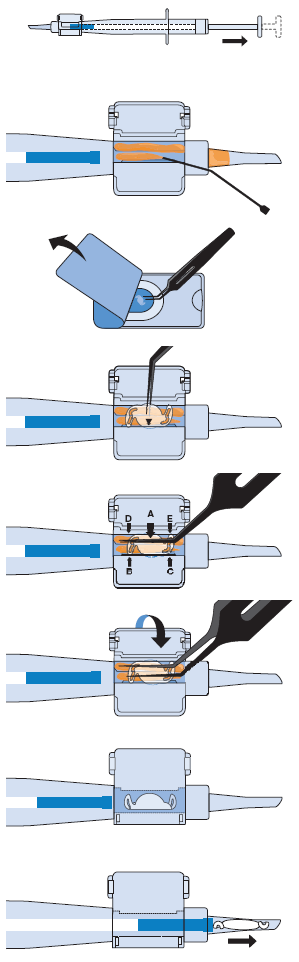 Osm kroků ke správné foldaci NOČ Rayner do jednorázového injektoru Rayner Krok 1 Asepticky přeneste injektor do sterilní oblasti vyklopením z obalu.