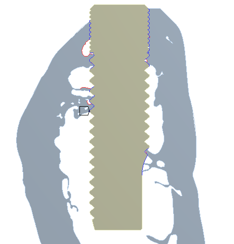 Jelikoţ byla modelována struktura spongiózní kostní tkáně, na úrovni trámečků byl volen stejný materiál jako u kosti kortikální.