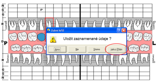 Pomocí takto připraveného cenového plánu (návrhu ošetření) se dá velmi snadno vystavit například laboratorní štítek.