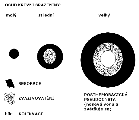 apoplexie (mohutné prokrvácení), melena (zelená stolice hemoglobin se ve střevě mění ve verdoglobin, který je zelený), enteroragie (krvácení do střev), gastroragie (krvácení do ţaludku).