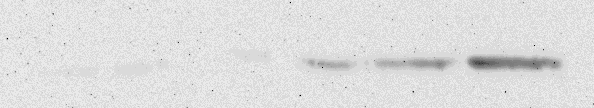 ředěna 1:1000 (anti-nt rabbit) a sekundární 1:2500 (anti-rabbit IgG/Px). Po inkubaci byl na 5 minut nanesen luminol. Po přeblotování proteinů byla membrána barvena v Ponceau S.