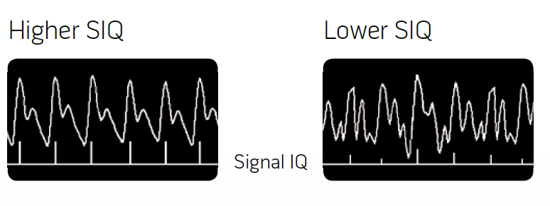 Signal IQ for